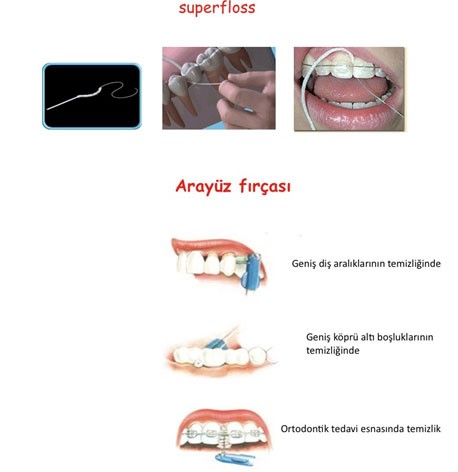 Ağız Bakımı Hakkında Bilmeniz Gerekenler - Diş Estetiği Merkezi